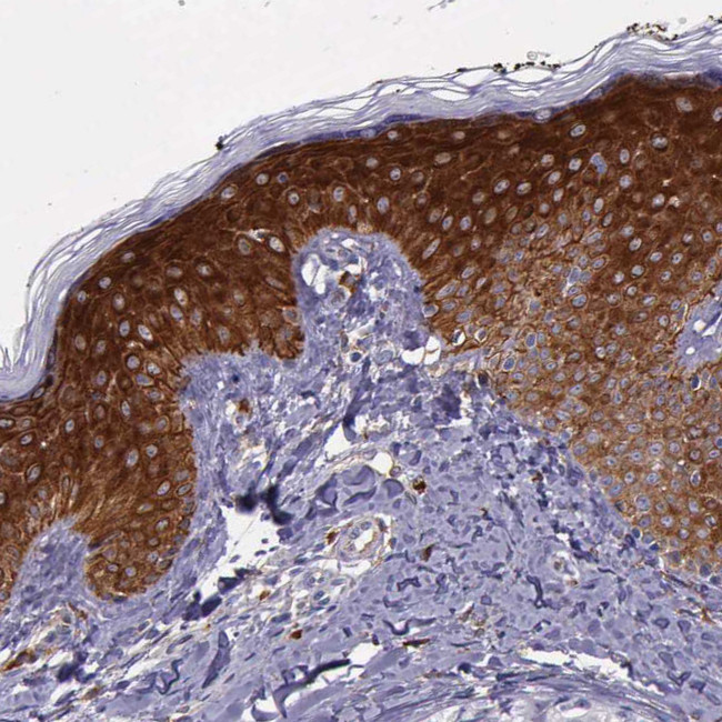 AHNAK2 Antibody in Immunohistochemistry (Paraffin) (IHC (P))