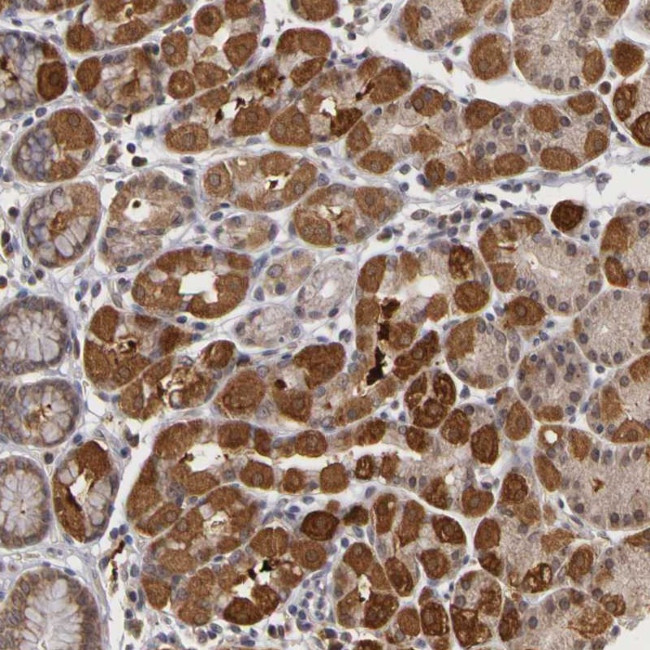 FRMD7 Antibody in Immunohistochemistry (Paraffin) (IHC (P))