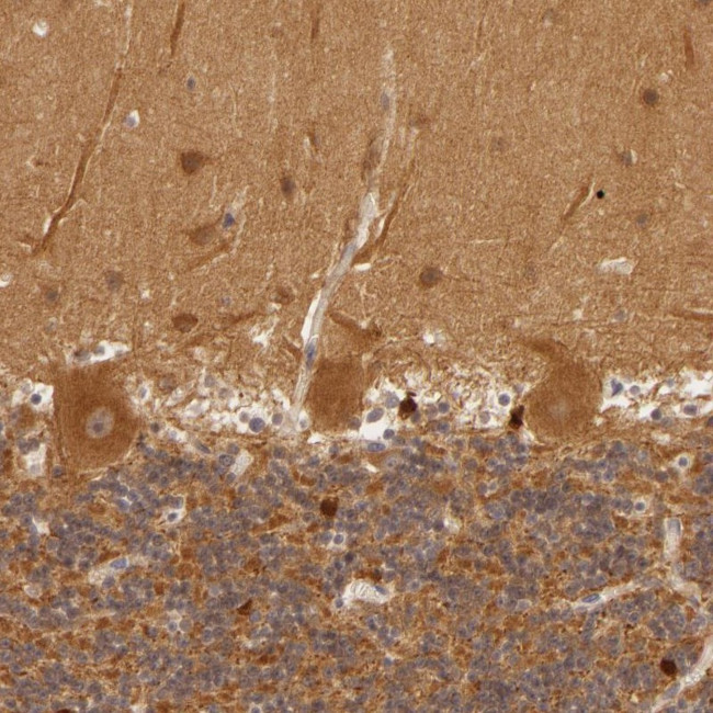 PPP1R3F Antibody in Immunohistochemistry (Paraffin) (IHC (P))