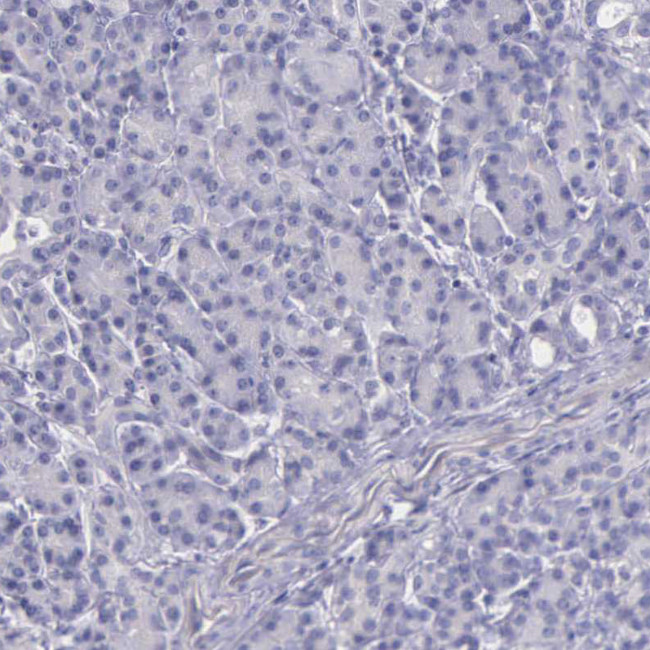 THSD7A Antibody in Immunohistochemistry (Paraffin) (IHC (P))
