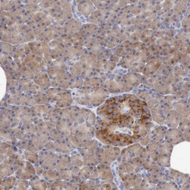 ANGEL1 Antibody in Immunohistochemistry (Paraffin) (IHC (P))