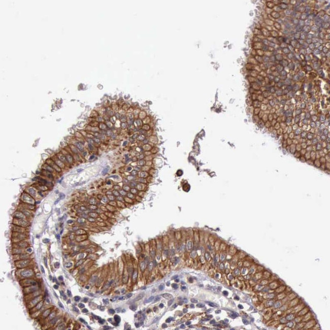 PRICKLE3 Antibody in Immunohistochemistry (Paraffin) (IHC (P))