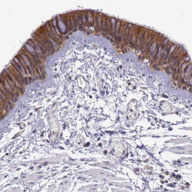 IGBP1 Antibody in Immunohistochemistry (IHC)