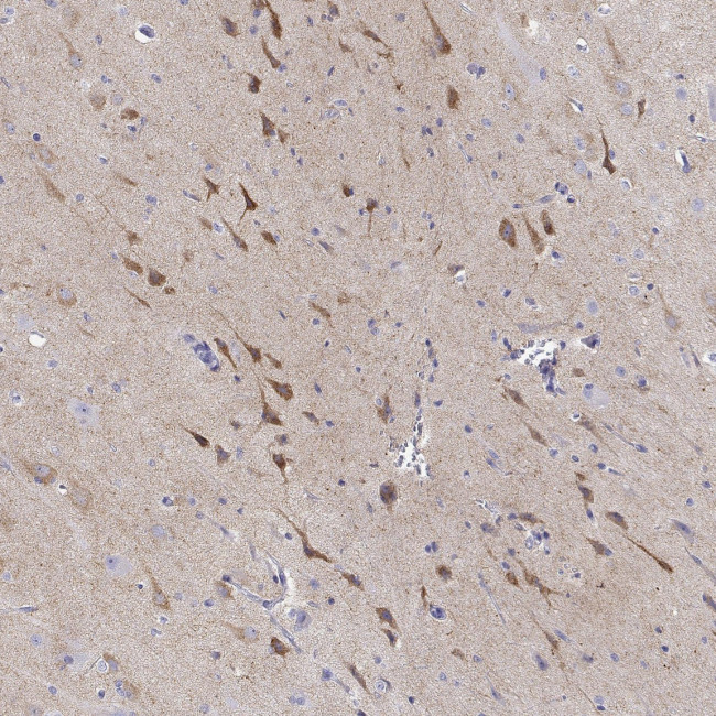 NPTXR Antibody in Immunohistochemistry (Paraffin) (IHC (P))