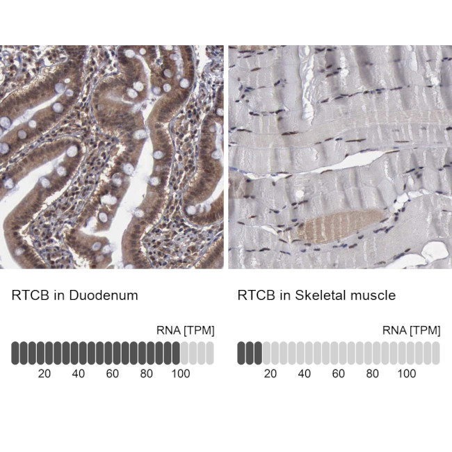 RTCB Antibody in Immunohistochemistry (IHC)