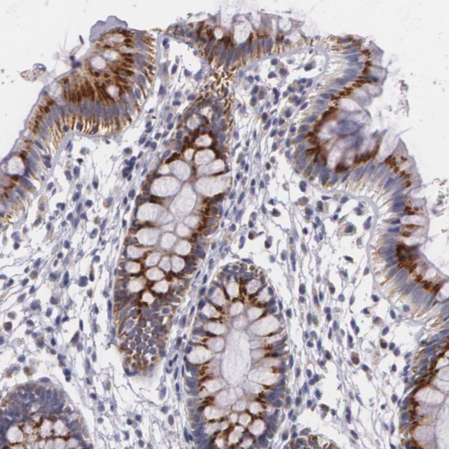 ICK Antibody in Immunohistochemistry (Paraffin) (IHC (P))