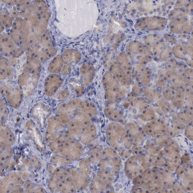 C14orf145 Antibody in Immunohistochemistry (Paraffin) (IHC (P))