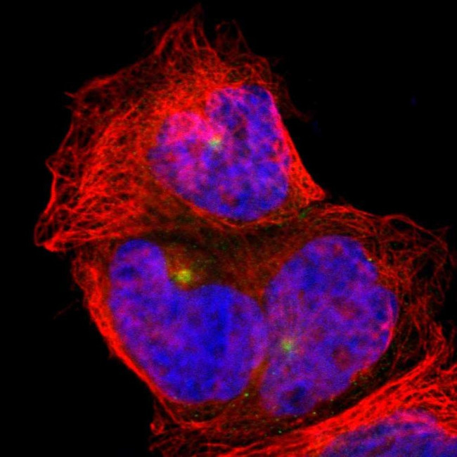 PLA2G6 Antibody in Immunocytochemistry (ICC/IF)