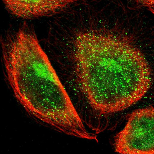 TBC1D22A Antibody in Immunocytochemistry (ICC/IF)