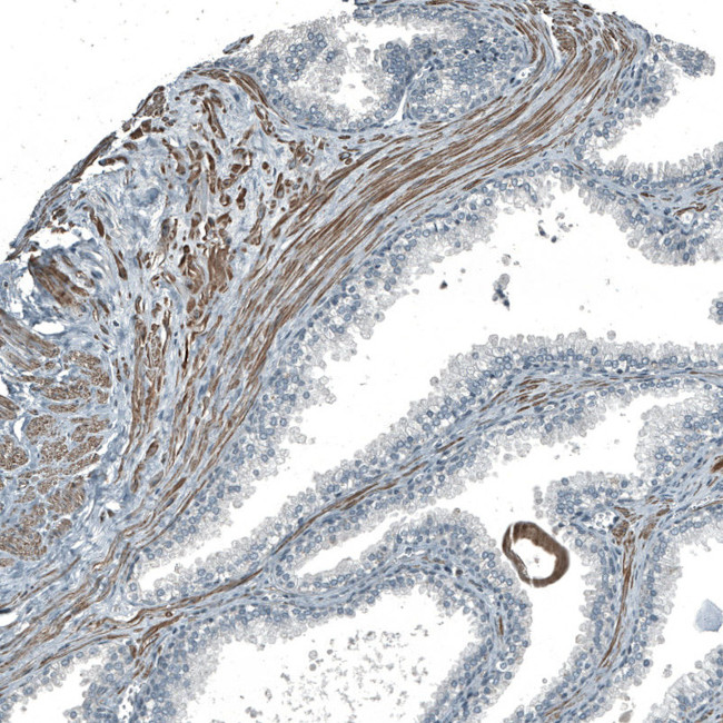 PIGA Antibody in Immunohistochemistry (Paraffin) (IHC (P))