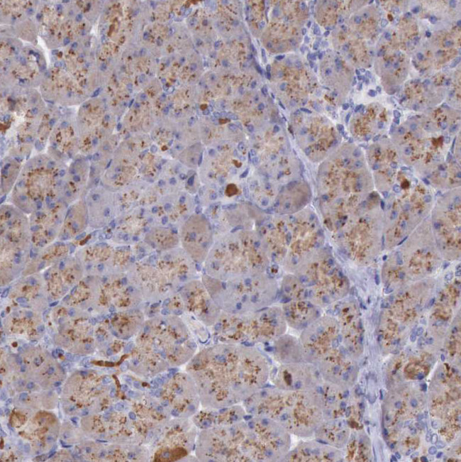 LRFN5 Antibody in Immunohistochemistry (Paraffin) (IHC (P))