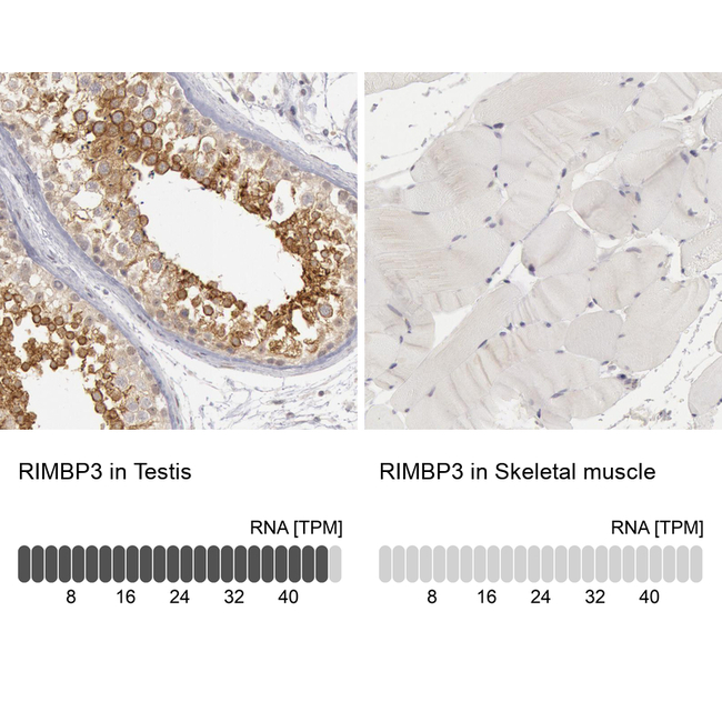 RIMBP3 Antibody in Immunohistochemistry (Paraffin) (IHC (P))