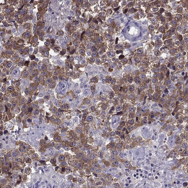 MAGEB1 Antibody in Immunohistochemistry (Paraffin) (IHC (P))