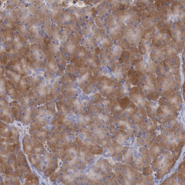 RNF139 Antibody in Immunohistochemistry (Paraffin) (IHC (P))