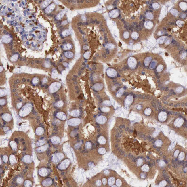 Pleckstrin 2 Antibody in Immunohistochemistry (Paraffin) (IHC (P))