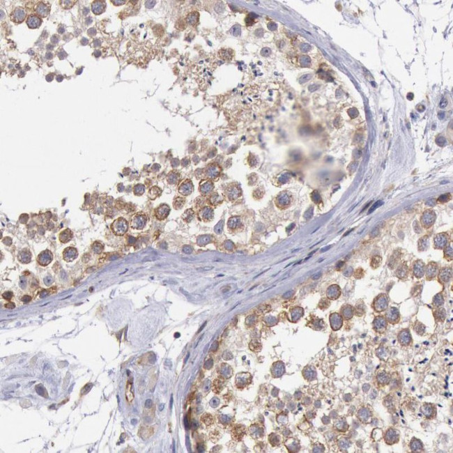 DRG1 Antibody in Immunohistochemistry (IHC)