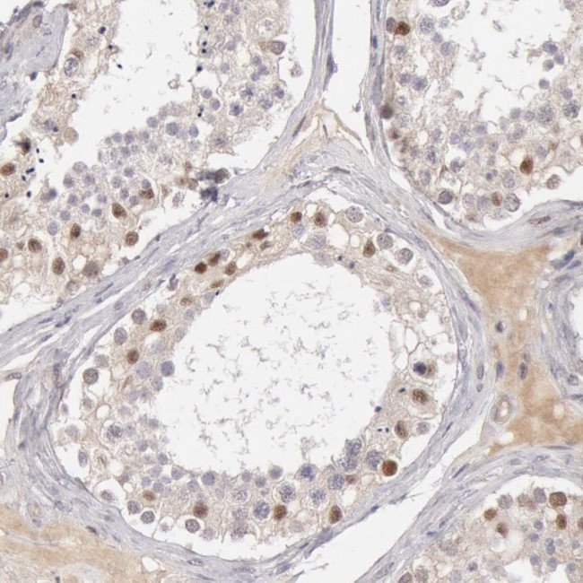 RGAG1 Antibody in Immunohistochemistry (Paraffin) (IHC (P))