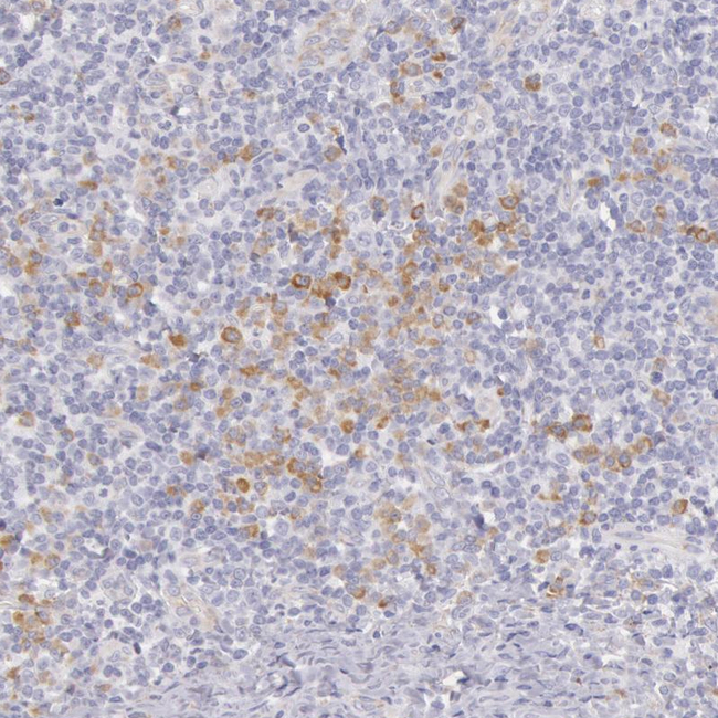 CIDEB Antibody in Immunohistochemistry (Paraffin) (IHC (P))