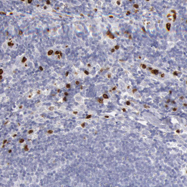 FCN1 Antibody in Immunohistochemistry (Paraffin) (IHC (P))