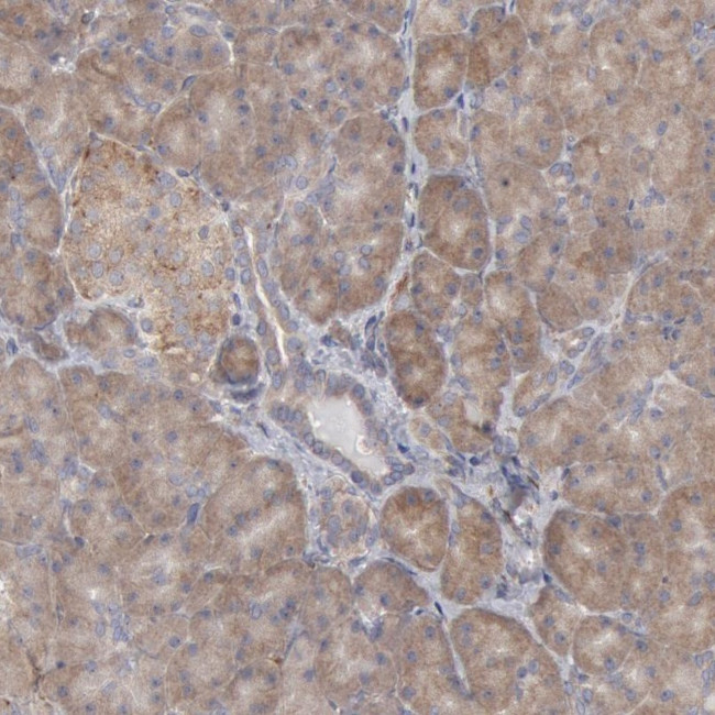 ORP8 Antibody in Immunohistochemistry (Paraffin) (IHC (P))