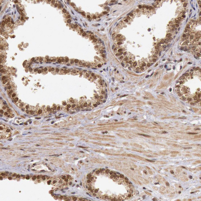 DNA ligase IV Antibody in Immunohistochemistry (IHC)