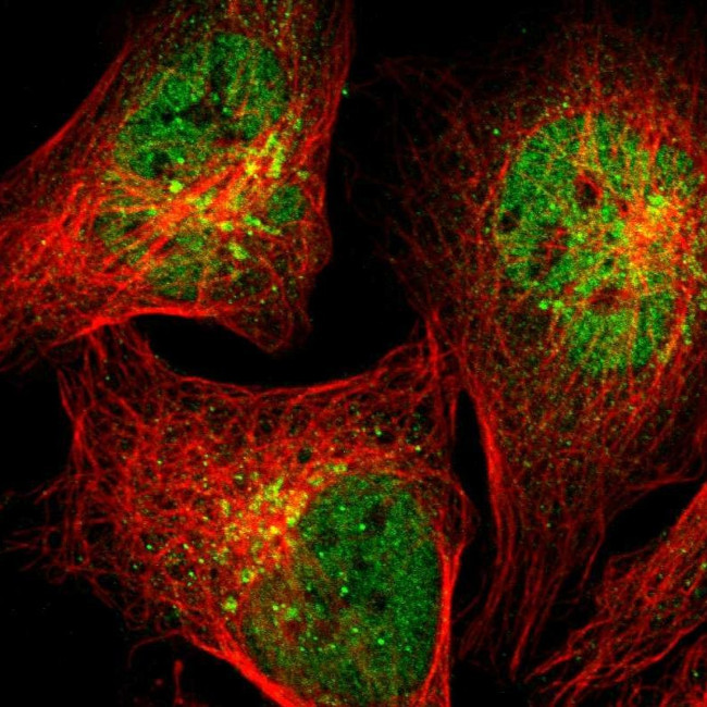 STX5 Antibody in Immunocytochemistry (ICC/IF)