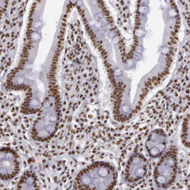 hnRNP H2 Antibody in Immunohistochemistry (IHC)