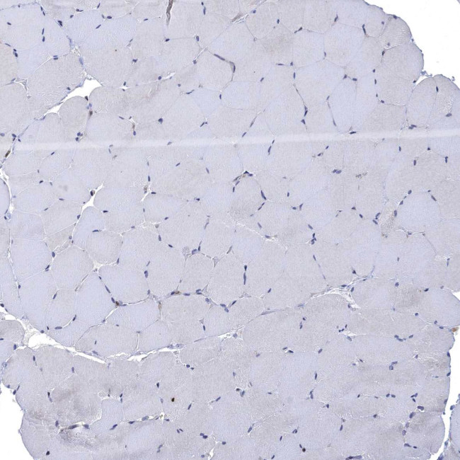 FES Antibody in Immunohistochemistry (Paraffin) (IHC (P))