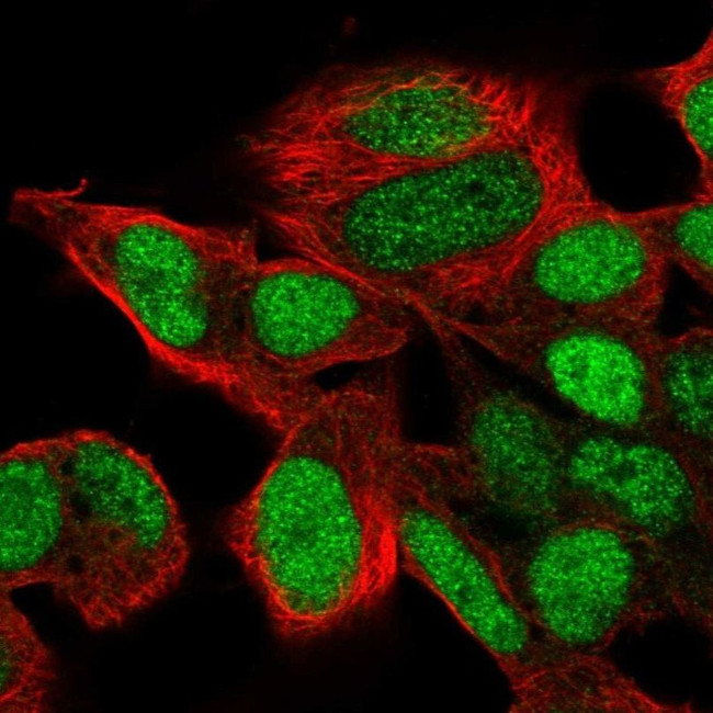 SIX6 Antibody in Immunocytochemistry (ICC/IF)