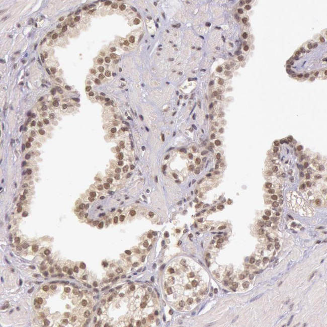 C22orf29 Antibody in Immunohistochemistry (Paraffin) (IHC (P))