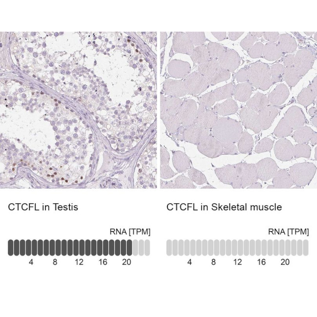 CTCFL Antibody in Immunohistochemistry (IHC)