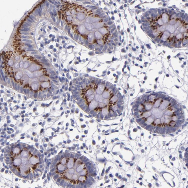 RAB41 Antibody in Immunohistochemistry (Paraffin) (IHC (P))