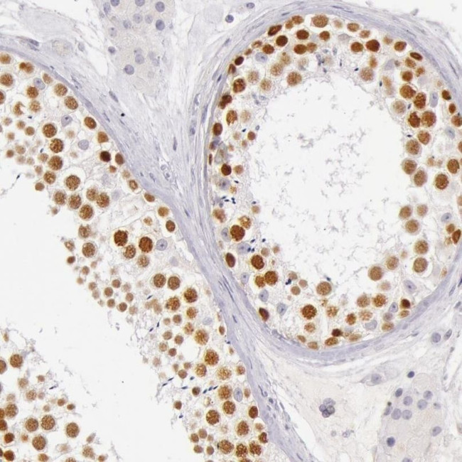 RBMY1A1 Antibody in Immunohistochemistry (IHC)