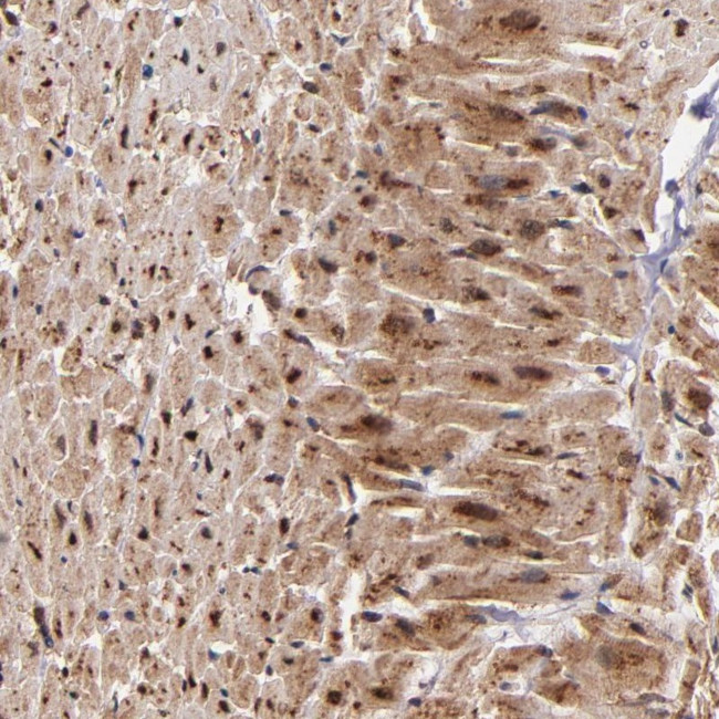 STX8 Antibody in Immunohistochemistry (Paraffin) (IHC (P))