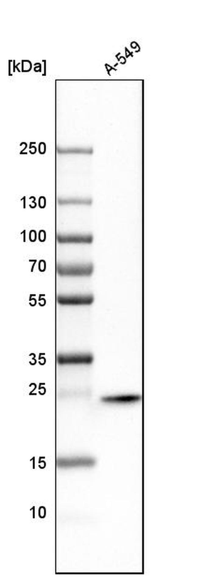 STX8 Antibody in Western Blot (WB)