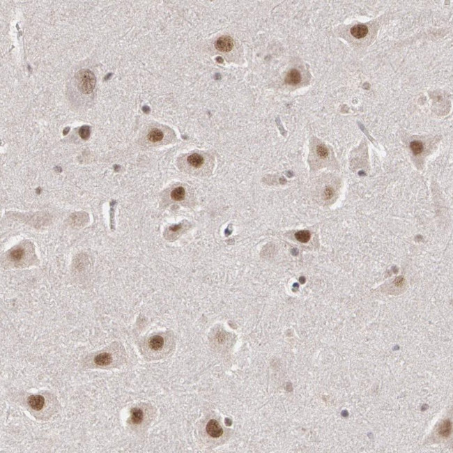 INTS6 Antibody in Immunohistochemistry (Paraffin) (IHC (P))