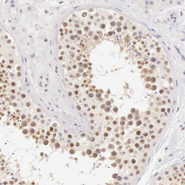 ZNF597 Antibody in Immunohistochemistry (Paraffin) (IHC (P))
