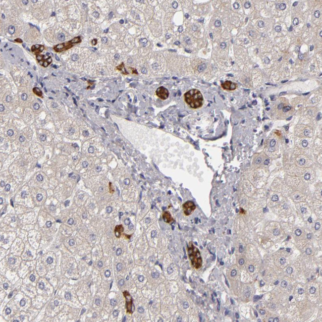EFS Antibody in Immunohistochemistry (Paraffin) (IHC (P))