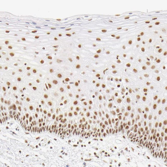 HCC1 Antibody in Immunohistochemistry (IHC)
