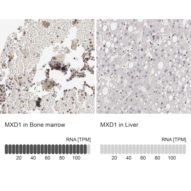 MXD1 Antibody in Immunohistochemistry (IHC)