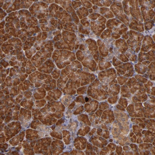 RIOK3 Antibody in Immunohistochemistry (Paraffin) (IHC (P))