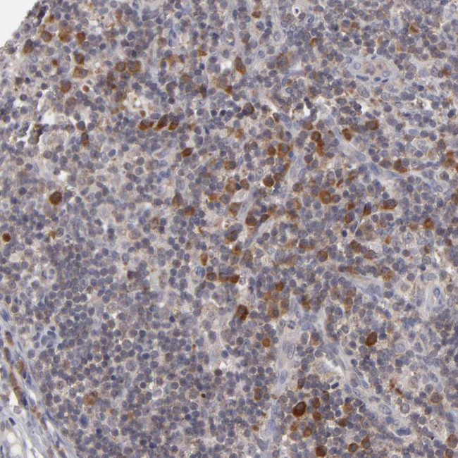 GLCCI1 Antibody in Immunohistochemistry (IHC)