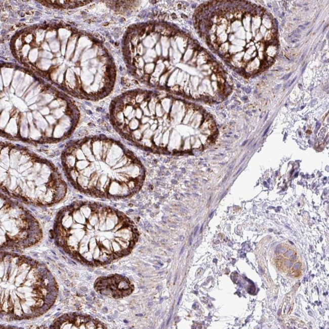 ZNF81 Antibody in Immunohistochemistry (Paraffin) (IHC (P))