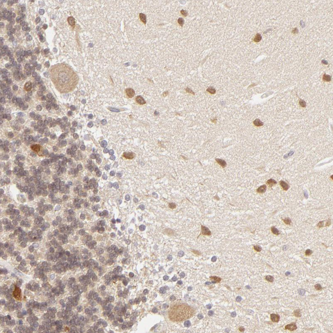 SAP102 Antibody in Immunohistochemistry (Paraffin) (IHC (P))