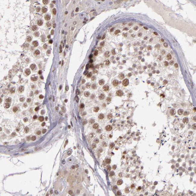 ZFX Antibody in Immunohistochemistry (Paraffin) (IHC (P))