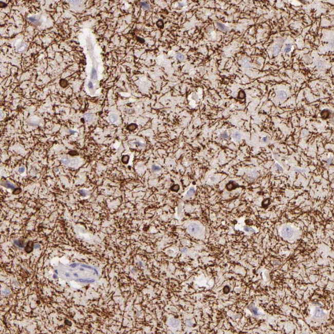 ZC3H7B Antibody in Immunohistochemistry (Paraffin) (IHC (P))