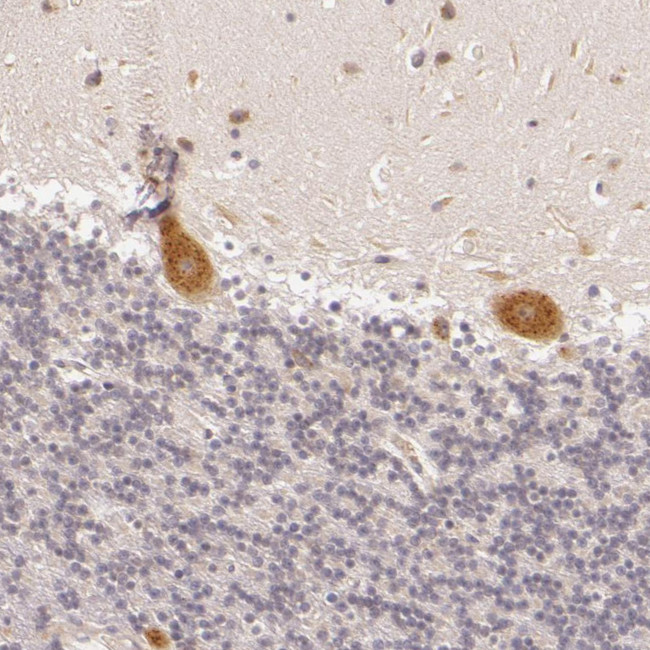 C14orf37 Antibody in Immunohistochemistry (Paraffin) (IHC (P))