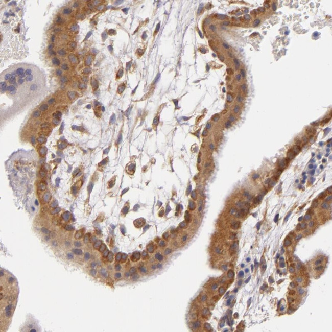 UPF3B Antibody in Immunohistochemistry (Paraffin) (IHC (P))