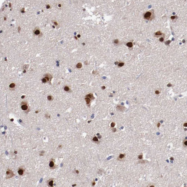 FAM81A Antibody in Immunohistochemistry (Paraffin) (IHC (P))