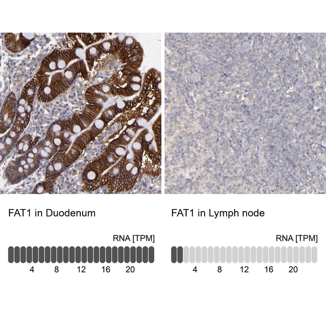 FAT1 Antibody in Immunohistochemistry (Paraffin) (IHC (P))